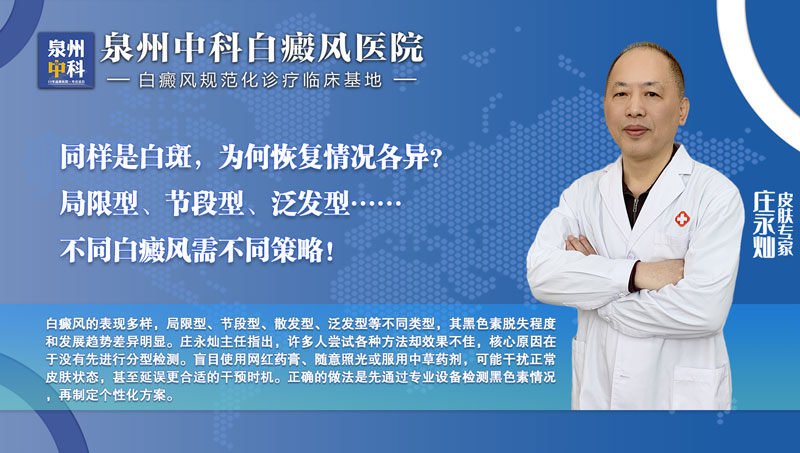 福建泉州中科皮肤白癜风医院庄永灿主任科普：白斑反复不见好？先查黑色素脱失程度再分型